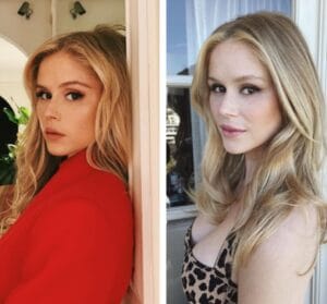 Erin Moriarty Before and After Cosmetic Surgery Transformation