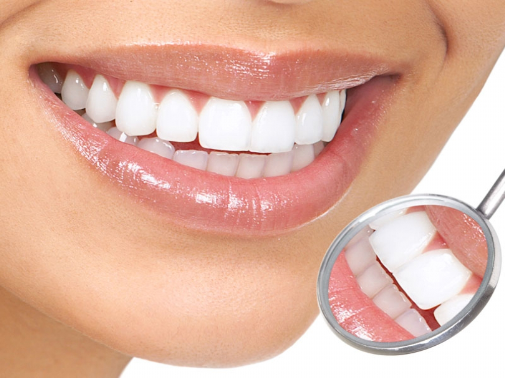 Zähne in türkei machen lassen